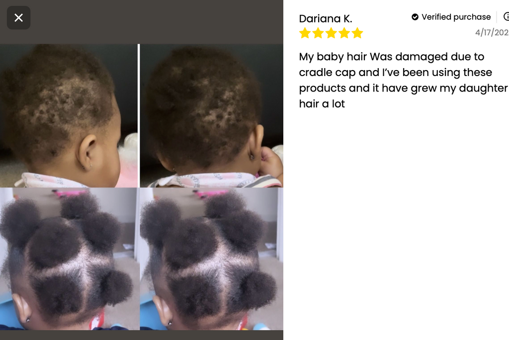 Kids' Scalp Stimulator — Natural Hair Grease for Curly, Coily & 4C Hair (No Greasy Buildup)