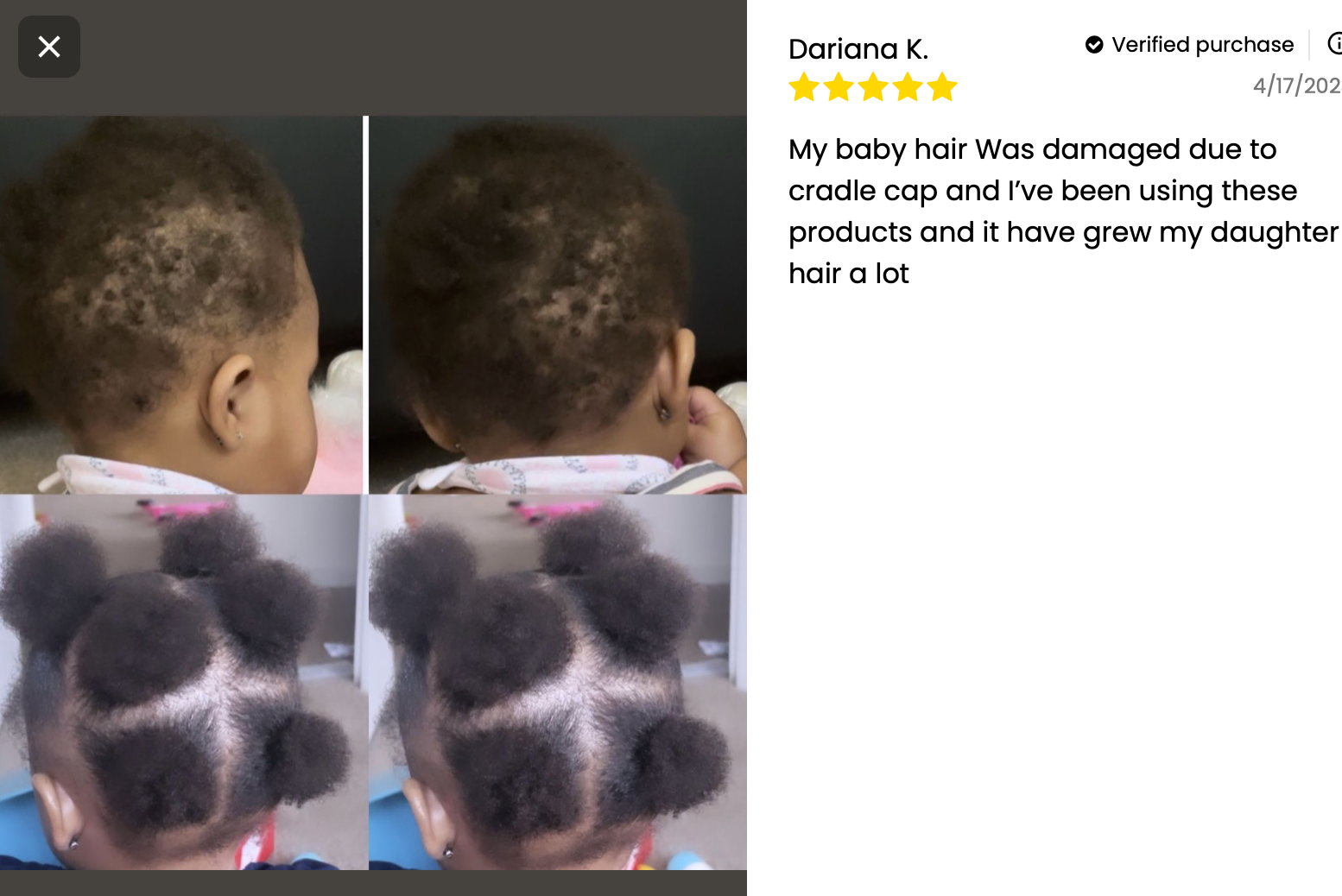Kids' Scalp Stimulator — Natural Hair Grease for Curly, Coily & 4C Hair (No Greasy Buildup)