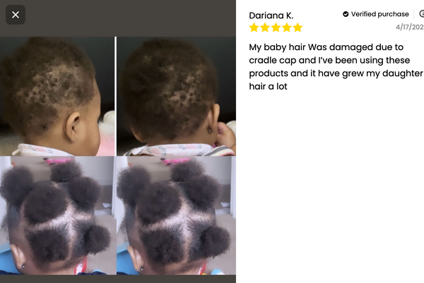 Kids' Scalp Stimulator — Natural Hair Grease for Curly, Coily & 4C Hair (No Greasy Buildup)