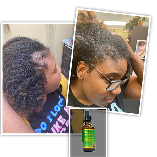 Hair Oil for 4C & Coily Hair – Nourishing Strengthening Scalp Serum, Natural | J'Organic Solutions