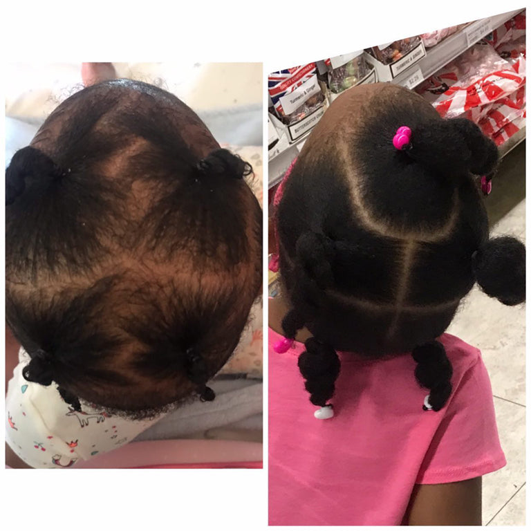 Kids' Healthy Hair Kit — 4-Step Natural Wash Day Routine for Curly, Coily & 4C Hair