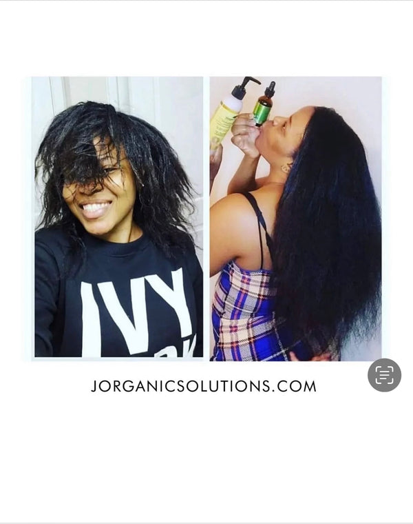 Curly Hair Care Kit for 4C & Coily Hair – 5-Product Natural Wash Day Bundle | J'Organic Solutions